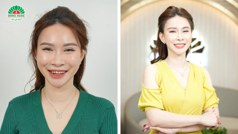 răng hàm mặt hồng ngọc