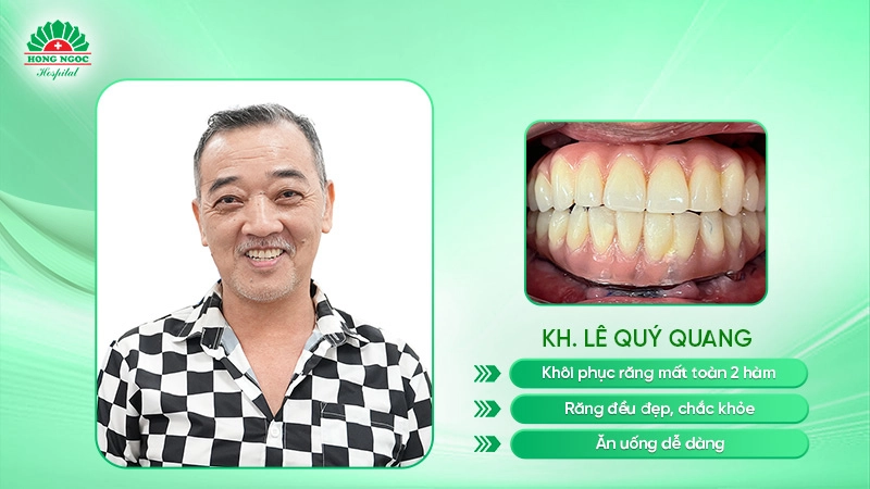 Trồng răng Implant