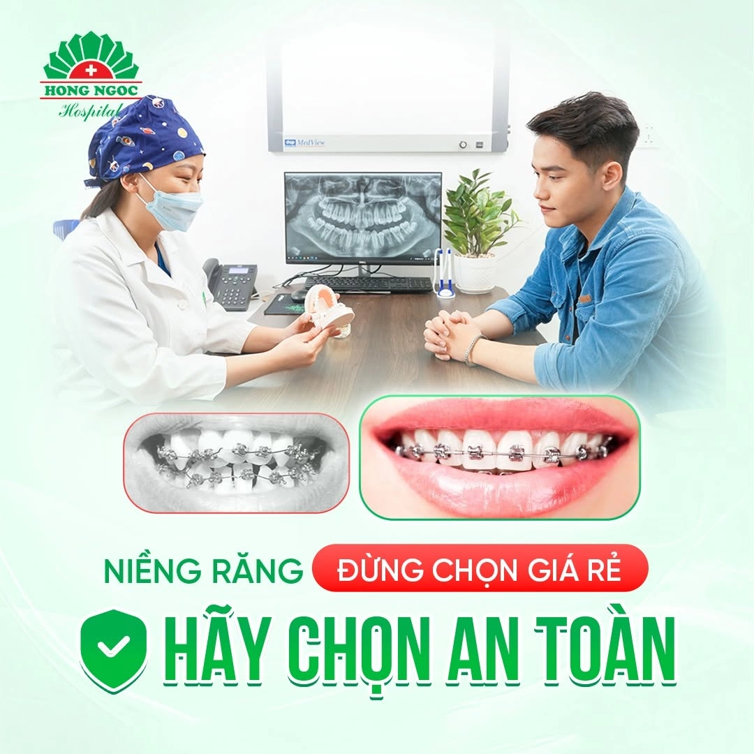 Trải nghiệm niềng răng khác biệt tại Răng Hàm Mặt Hồng Ngọc