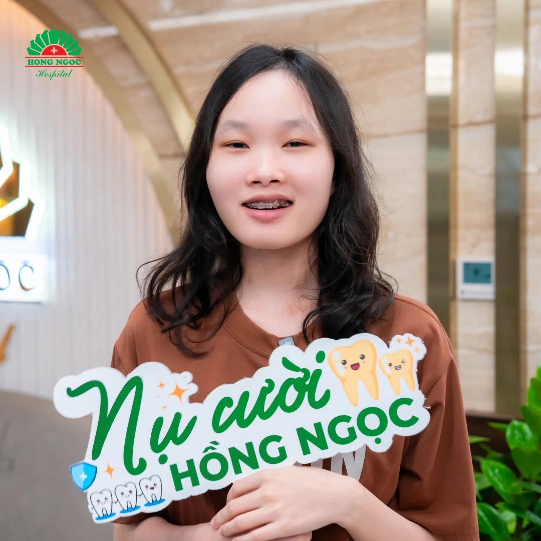 Bước 4: Theo dõi định kỳ và điều chỉnh lực kéo