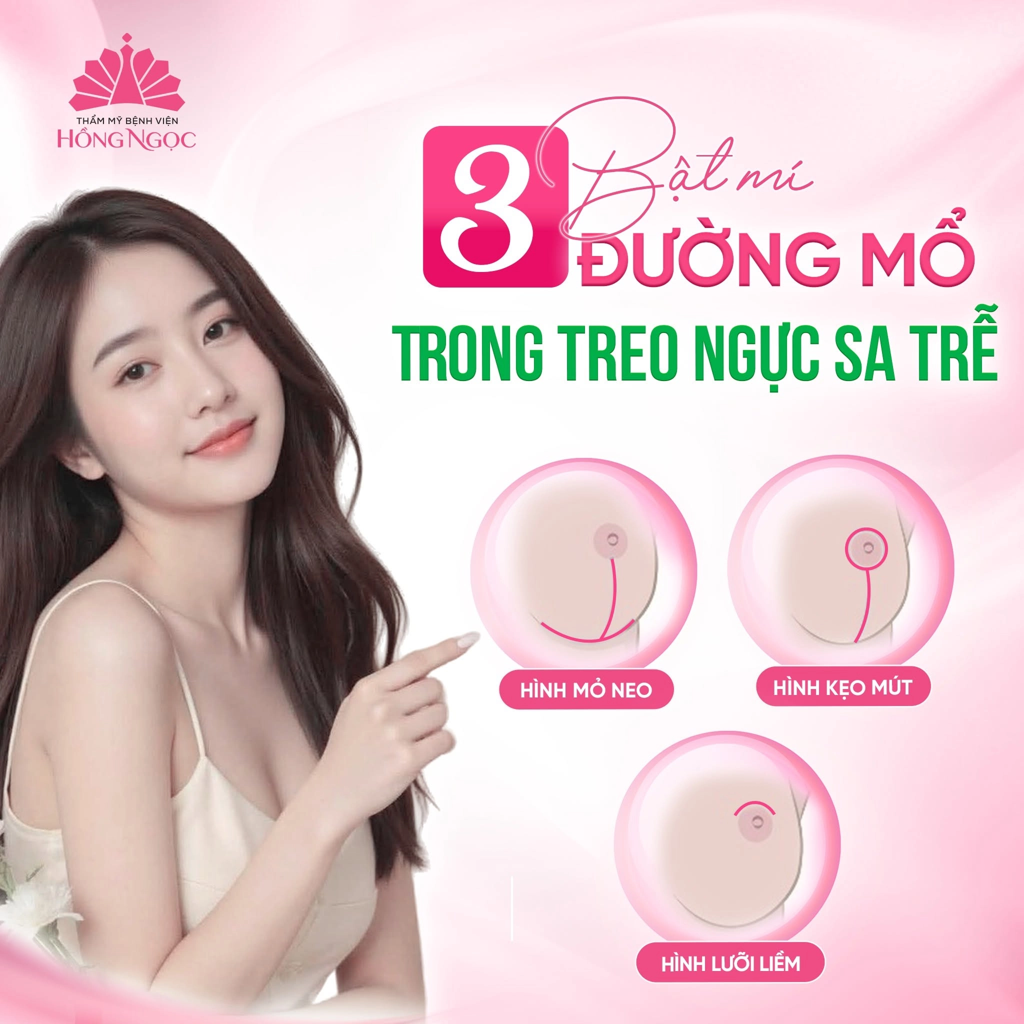 Các kỹ thuật thu gọn ngực phổ biến hiện nay