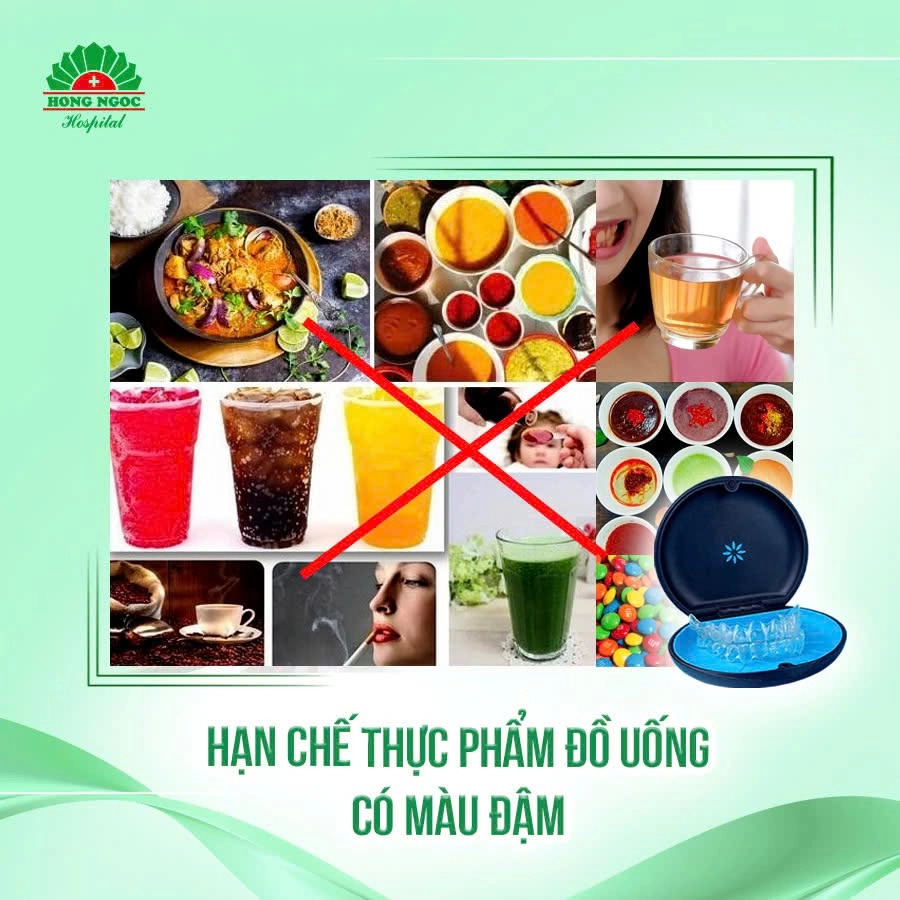 Lưu ý ăn uống sau khi niềng răng