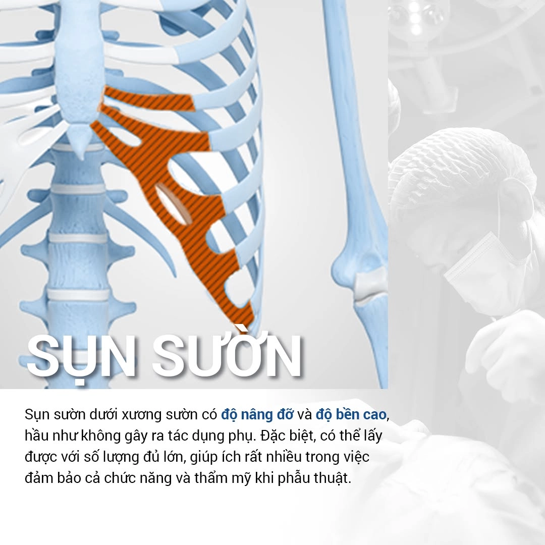 Ai nên và không nên nâng mũi bằng sụn xương sườn?