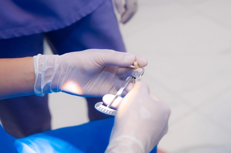 ai phù hợp với răng sứ cercon