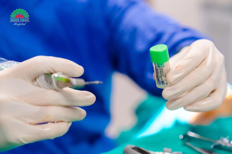 bác sĩ đặt trụ implant