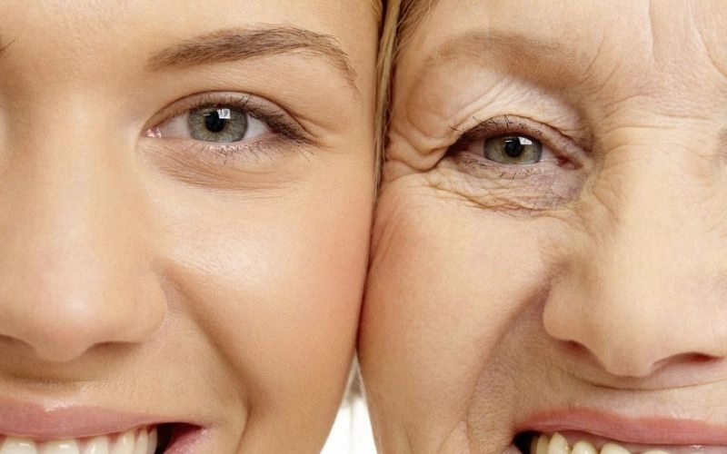 cắt mí cho người lớn tuổi là gì