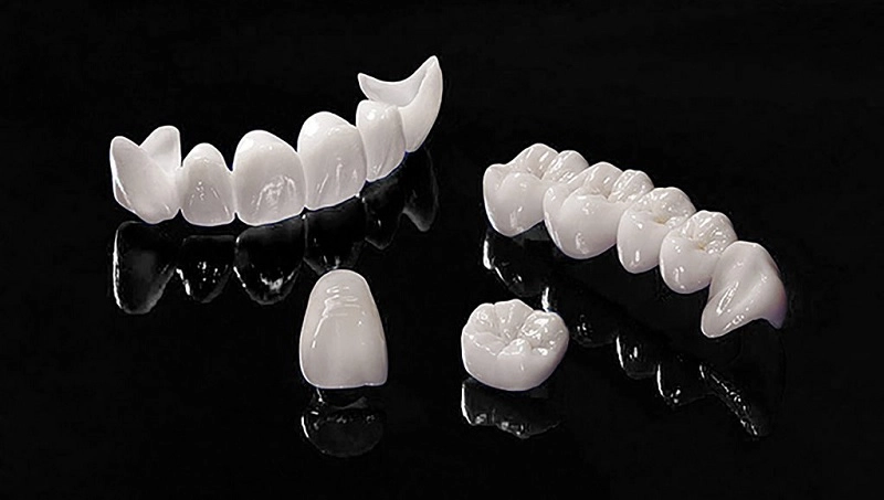 cấu tạo răng sứ cercon