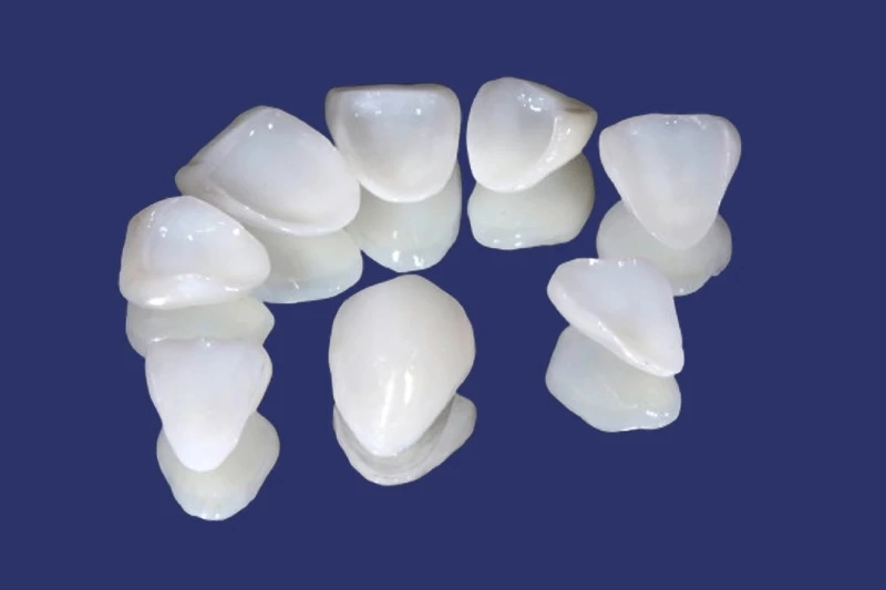 cấu tạo Veneer Emax