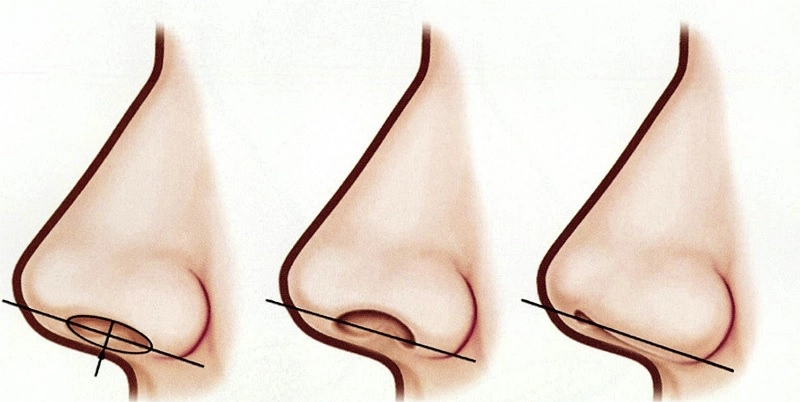 cấu trúc cánh mũi