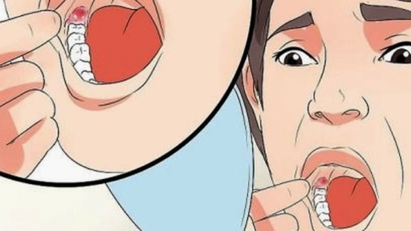 chảy máu khi nhổ răng 8