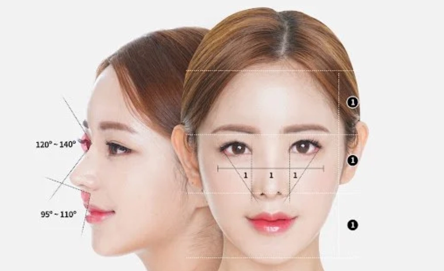 Nâng mũi bọc sụn