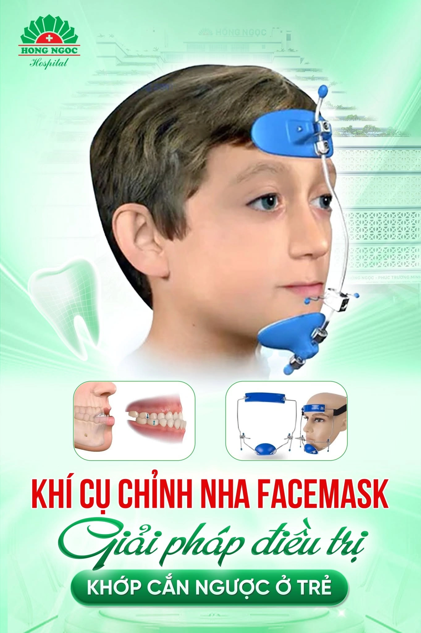 Quy trình chỉnh nha cho trẻ em tại Răng Hàm Mặt Hồng Ngọc