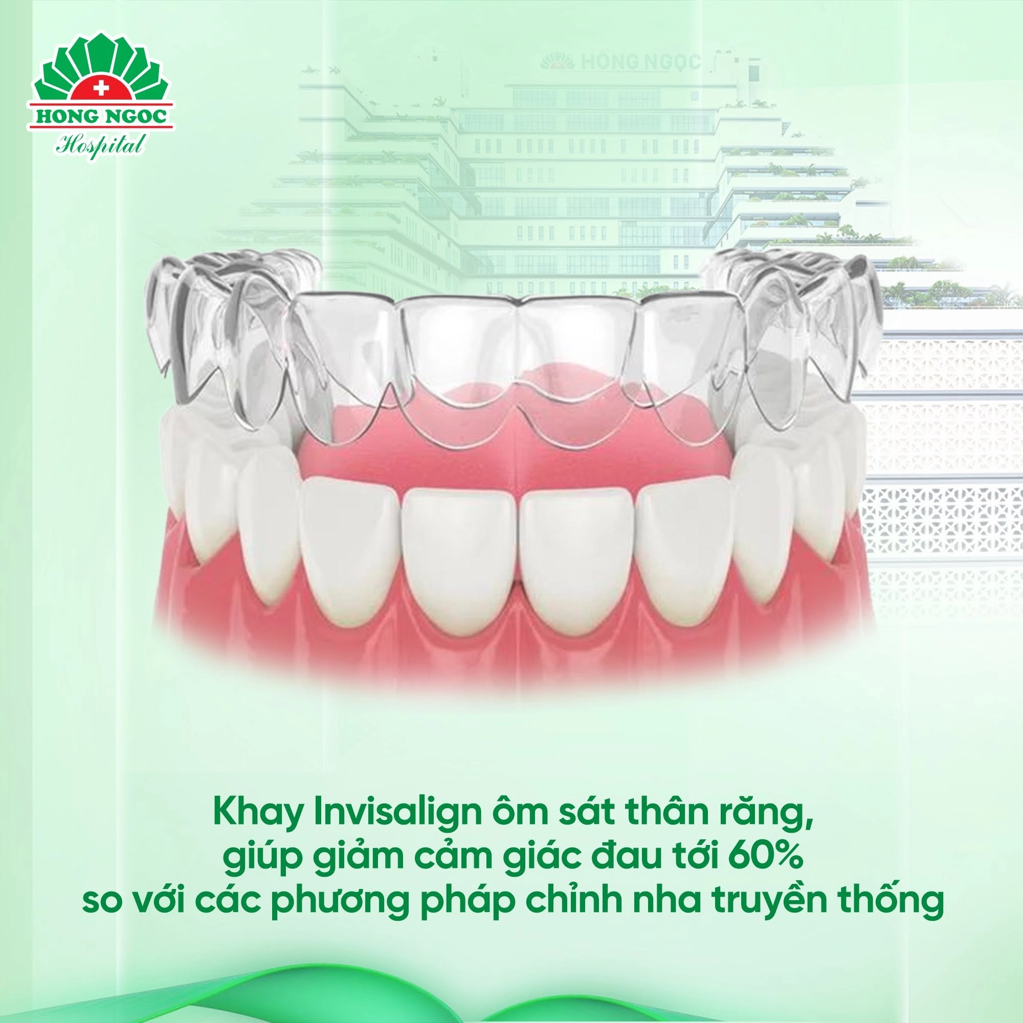 Vì sao nhiều người chọn chỉnh nha bằng khay trong suốt Invisalign&nbsp;thay vì mắc cài truyền thống?