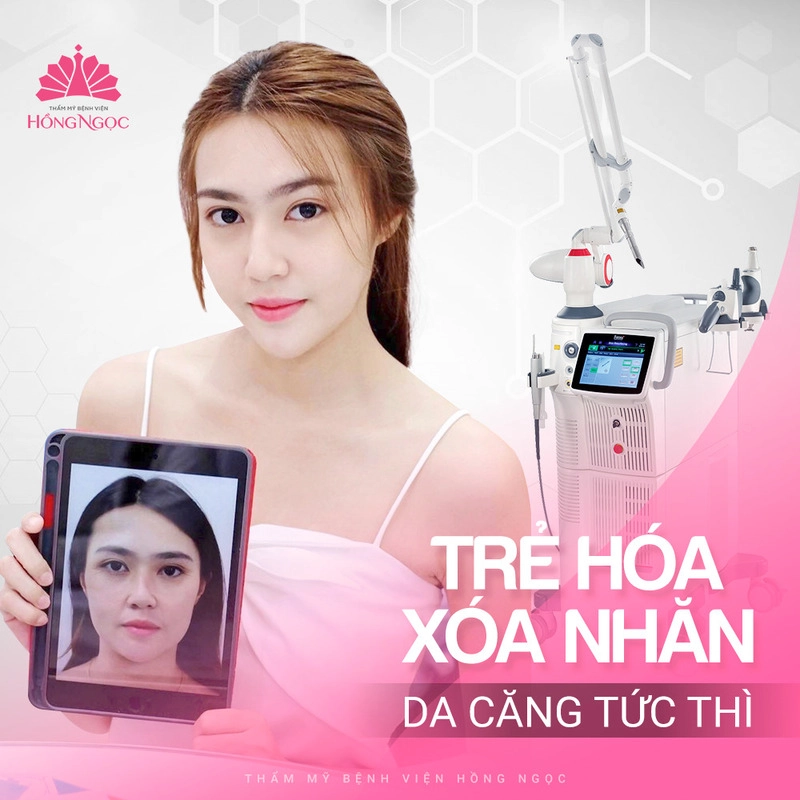 công nghệ laser trẻ hóa