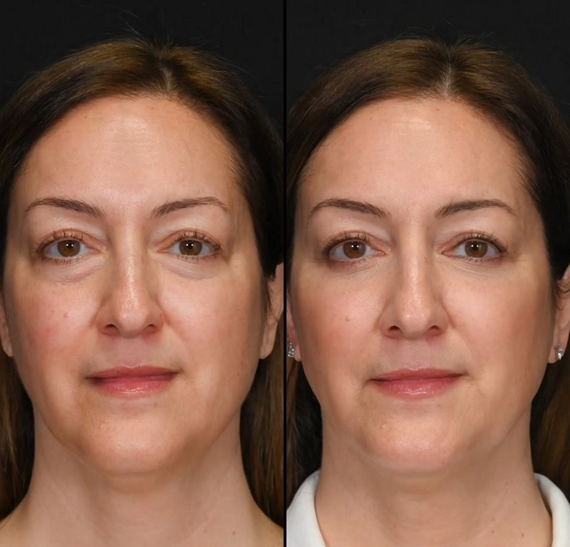 đánh giá tình trạng mắt trước phẫu thuật