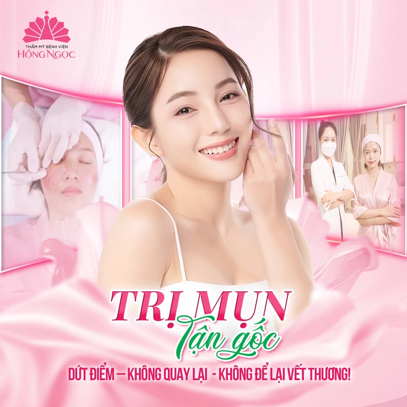 điều trị mụn thẩm mỹ