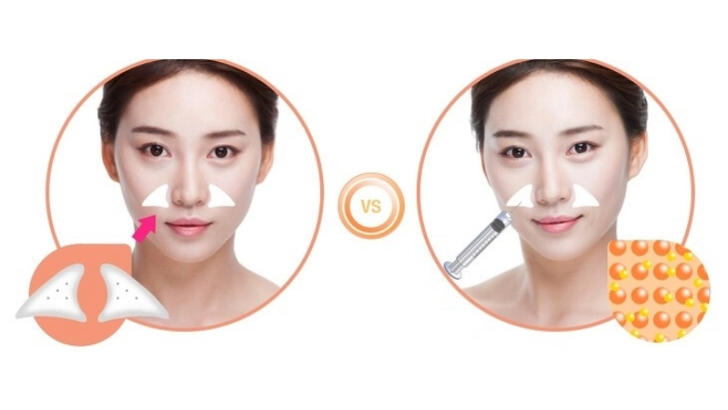 độn rãnh cười