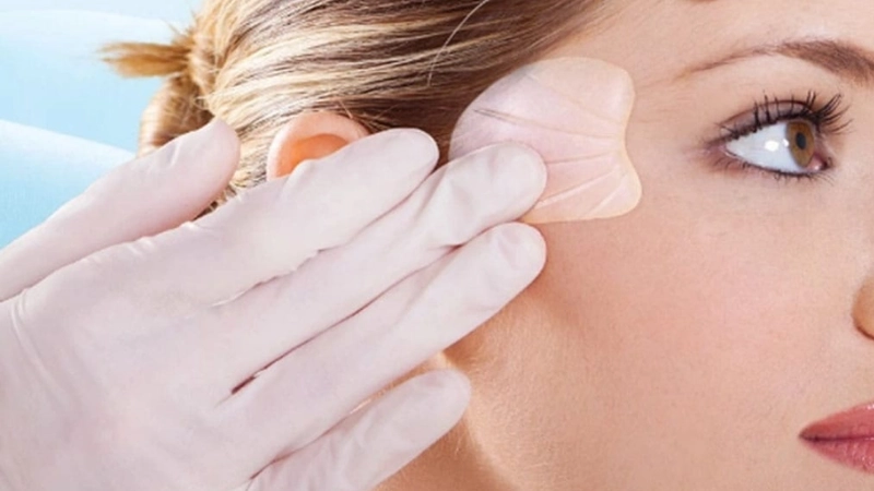 độn thái dương