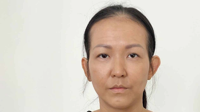 độn thái dương