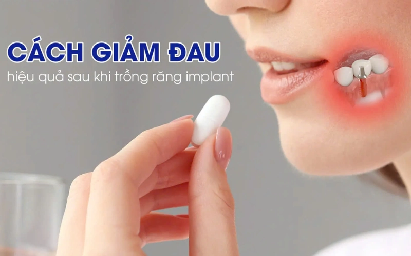 Những lưu ý giúp giảm đau sau khi trồng răng Implant