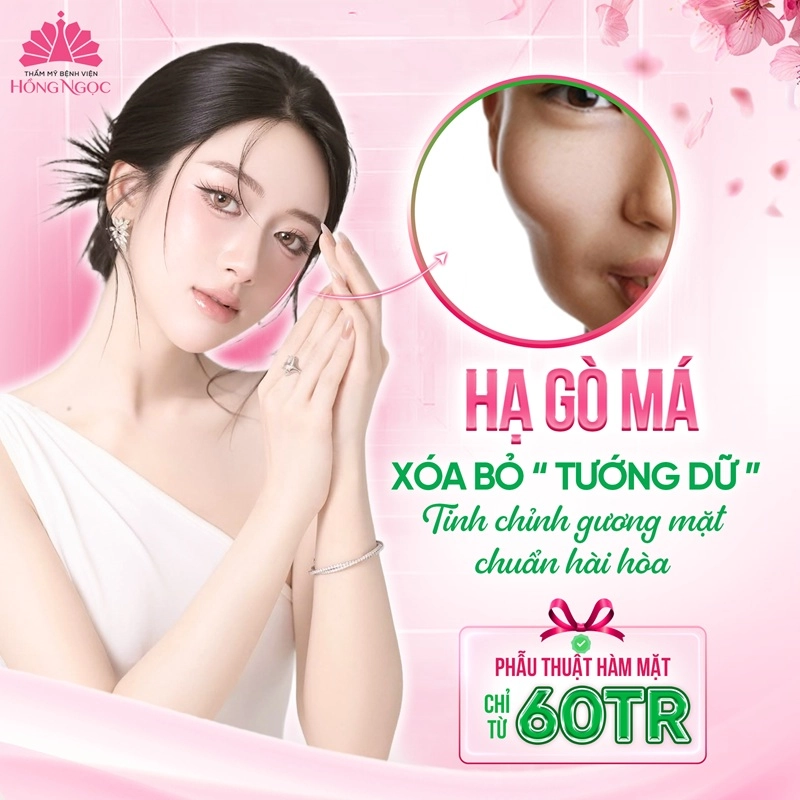 hạ gò má bao nhiêu tiền
