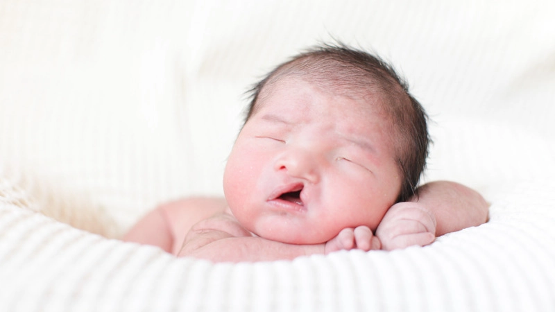 hở hàm ếch là gì