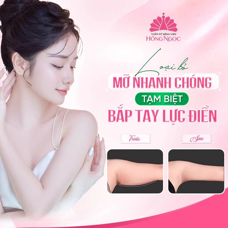 hút mỡ bắp tay có an toàn không