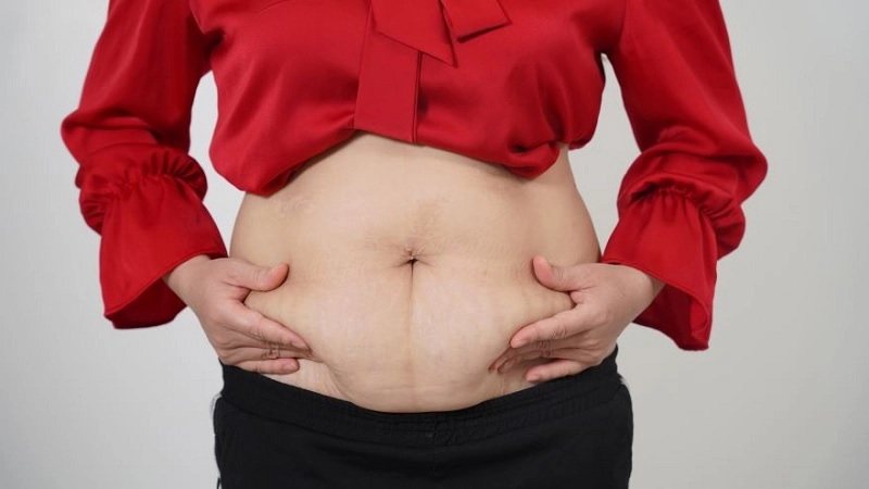 hút mỡ bụng laser lipo