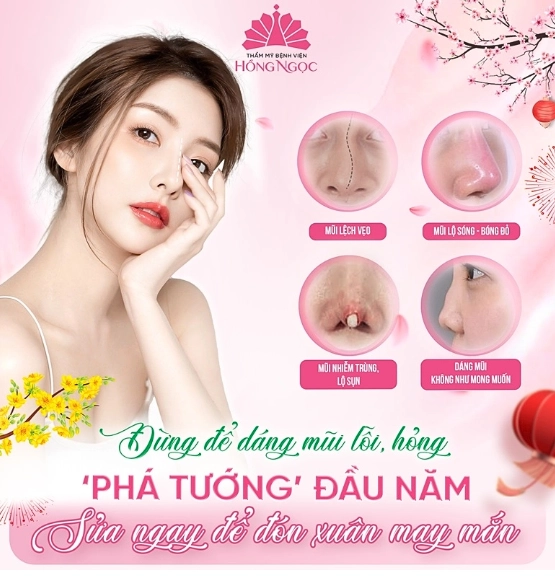 sửa mũi lệch