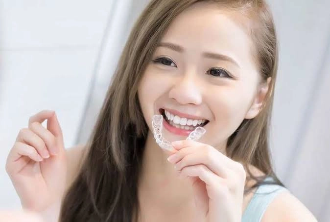 Niềng răng Invisalign bao lâu thì được tháo?