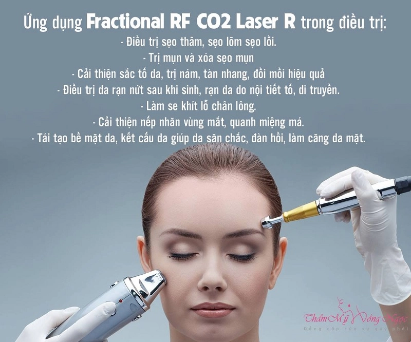 laser tái tạo da