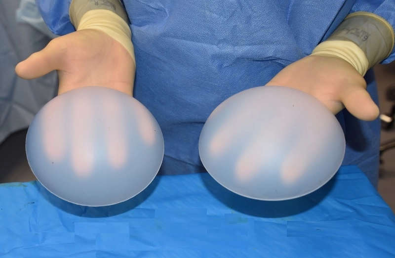 nâng mông bằng túi độn silicon