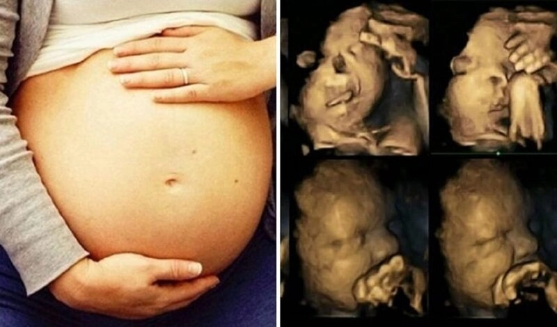 nguyên nhân hở hàm ếch