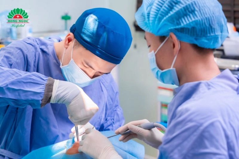 nhổ răng khôn hàm dưới có đau không