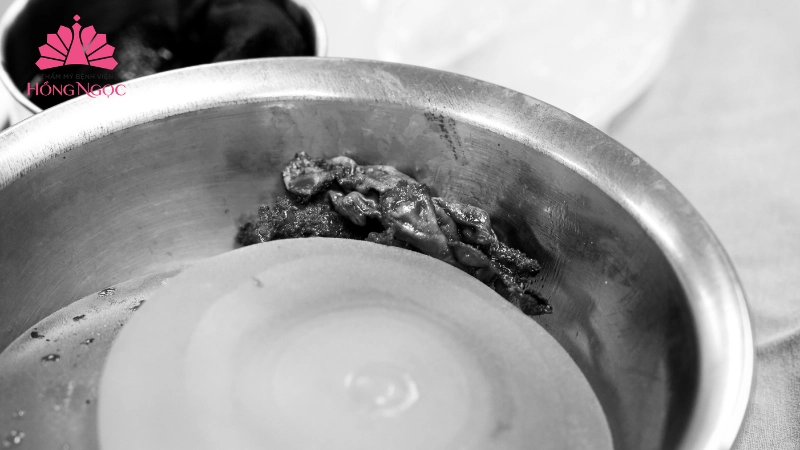 lưu ý cần biết trước khi nâng ngực