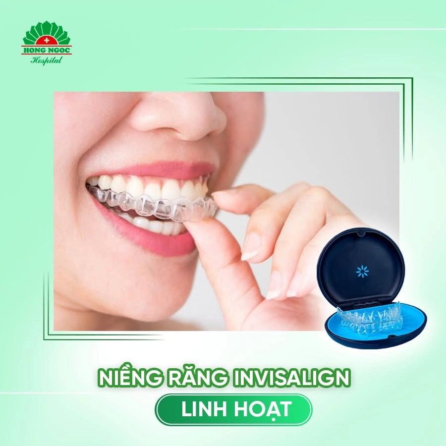 Niềng răng trong suốt