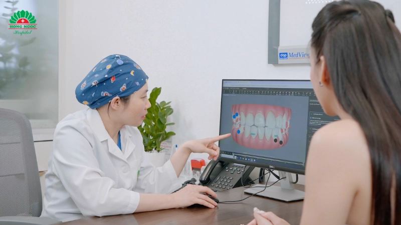 niềng răng hay bọc răng sứ