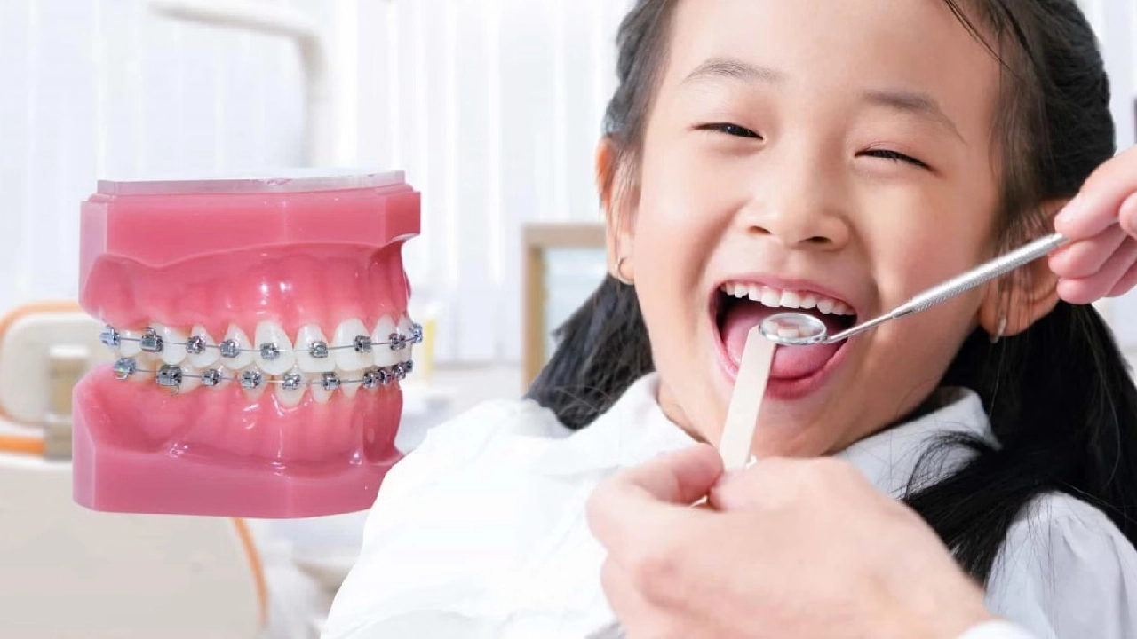 Niềng răng có ảnh hưởng gì không?