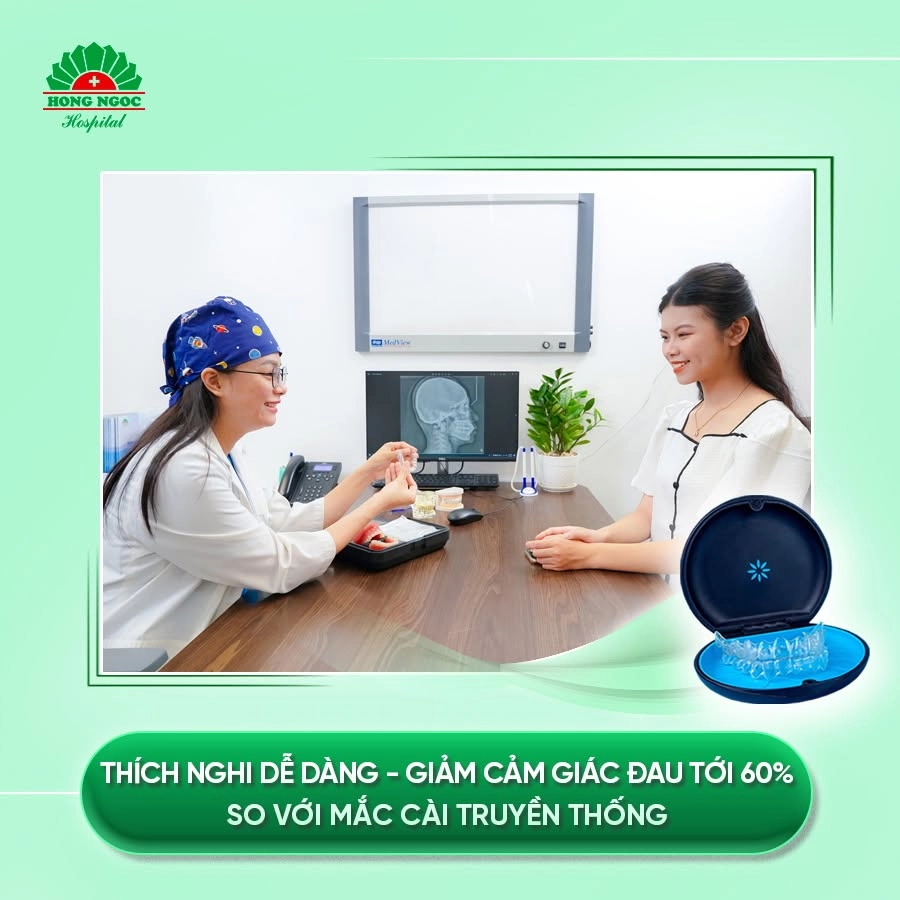 Ưu điểm của niềng răng trong suốt
