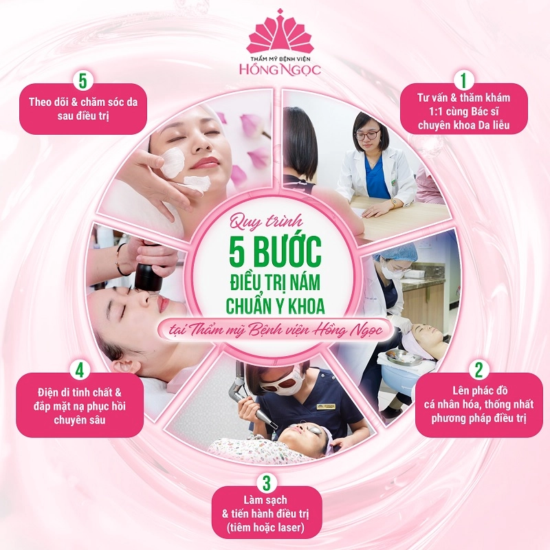 phác đồ điều trị nám tại hồng ngọc