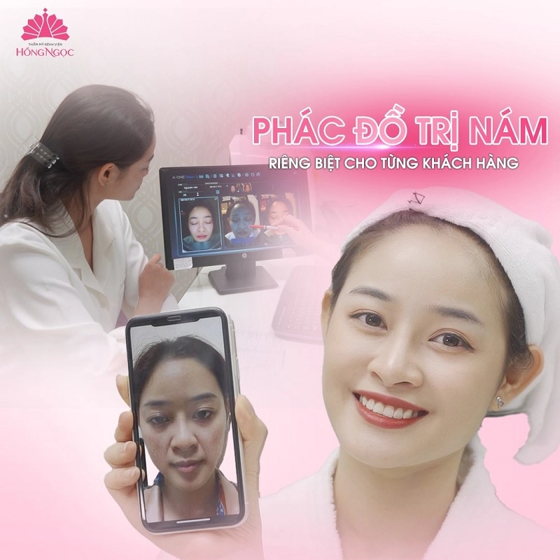 phác đồ trị nám chuyên biệt