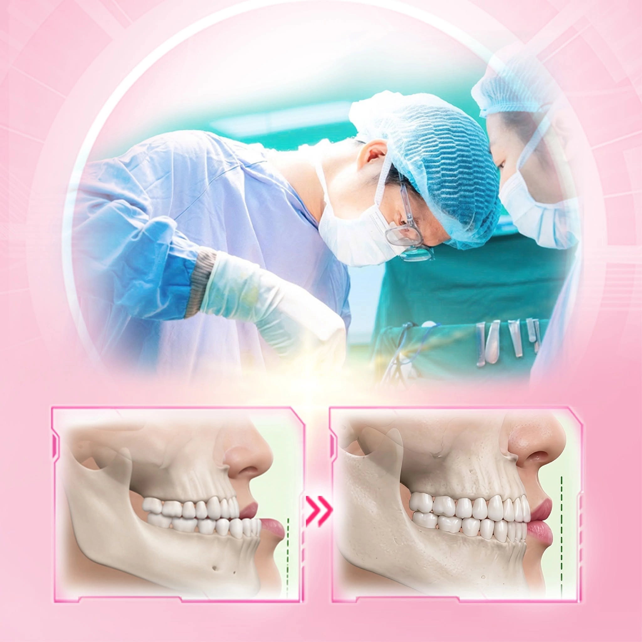 Các phương pháp nắn chỉnh hô, móm hiệu quả hiện nay