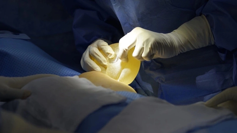 phẫu thuật nâng ngực 