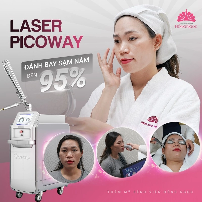 phương pháp làm da khỏe mạnh bằng laser
