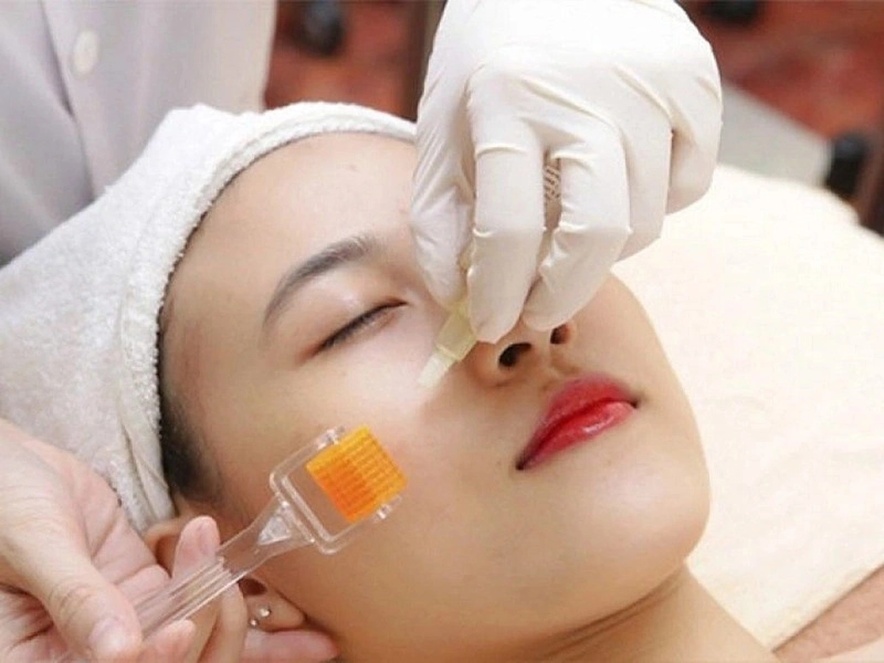 Phương pháp trị mụn thẩm mỹ