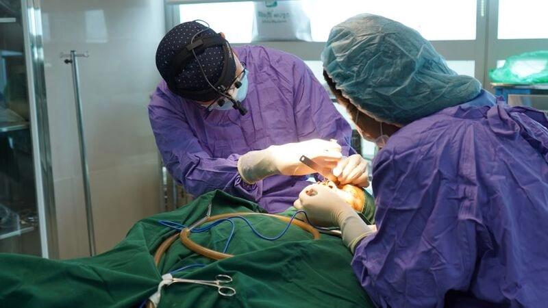 quá trình thực hiện nâng mũi bán cấu trúc