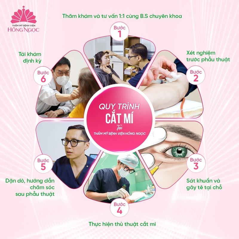 quy trình cắt mí tại hồng ngọc