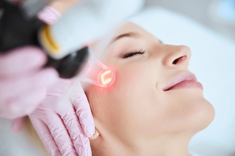 quy trình thực hiện laser trẻ hoá da