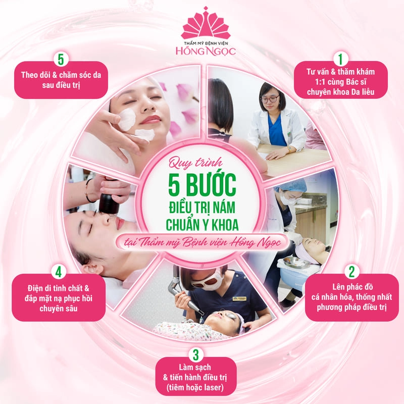 quy trình trị nám tại hồng ngọc