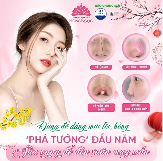 Quy trình sửa mũi lệch